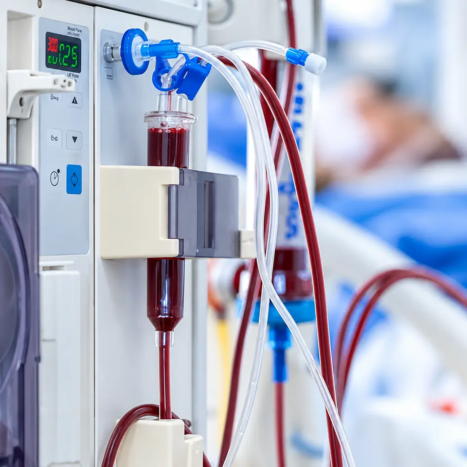A haemodialysis machine running a treatment, with the drip chamber and bloodline tubing in focus and a patient resting behind it